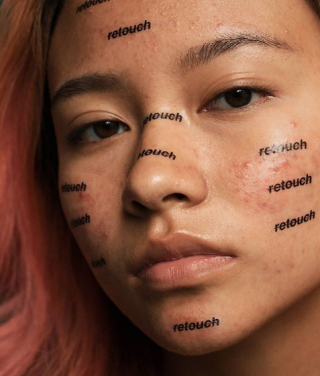 La battaglia di Cara Delevingne contro Photoshop: "L'acne è normale" La battaglia di Cara Delevingne contro Photoshop: "L'acne è normale"