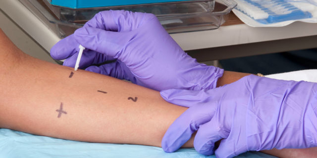 Prick test allergici