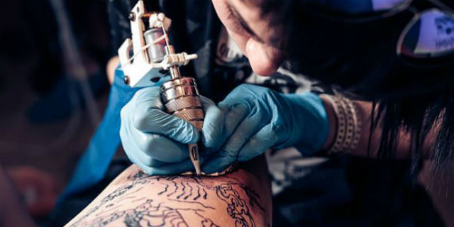 rimozione tatuaggi costo