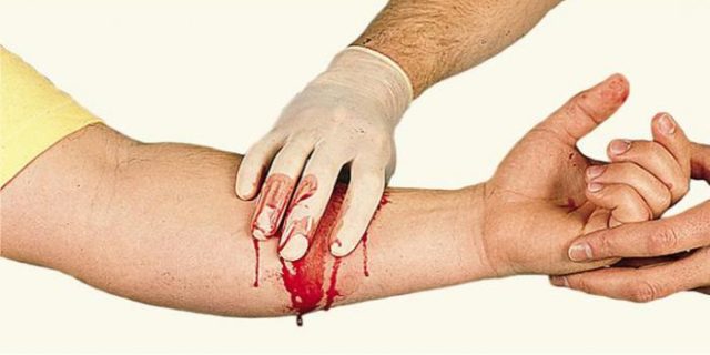 sangue