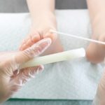 ASCUS: cosa ci dicono le cellule alterate nel pap test?