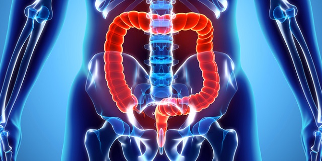 Dolicocolon rimedi