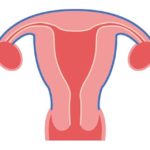 Annessite, quella malattia femminile che infiamma utero e ovaie