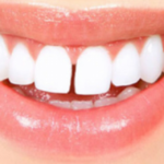 Tutto ciò che c'è da sapere sul diastema, l'intervallo tra i denti di moda anche tra le star