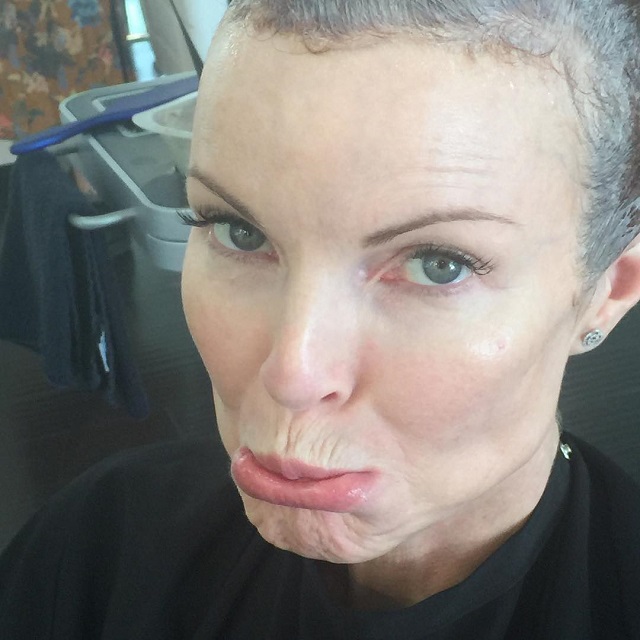 Marcia Cross dopo il tumore: "Non dobbiamo vergognarci di parlare di cancro anale"