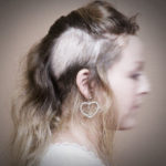 Tricotillomania, quando strapparsi i capelli fino alla calvizie è una necessità