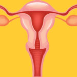 Chiusura delle tube: se una donna non vuole figli può farla?