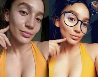 Cos’è la Snapchat dismorfia: la filtri mania che sta arricchendo la chirurgia estetica