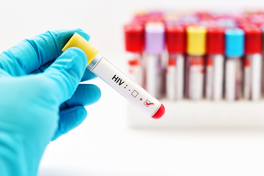 Non solo HIV: 7 malattie sessualmente trasmissibili, poco o per nulla conosciute