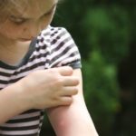 Citronella e non solo: 4 efficaci rimedi contro le zanzare