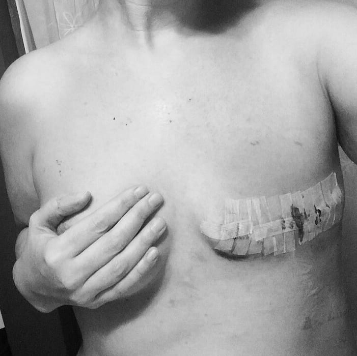 "Questo è il cancro al seno: ve lo mostro senza nascondervi nulla”