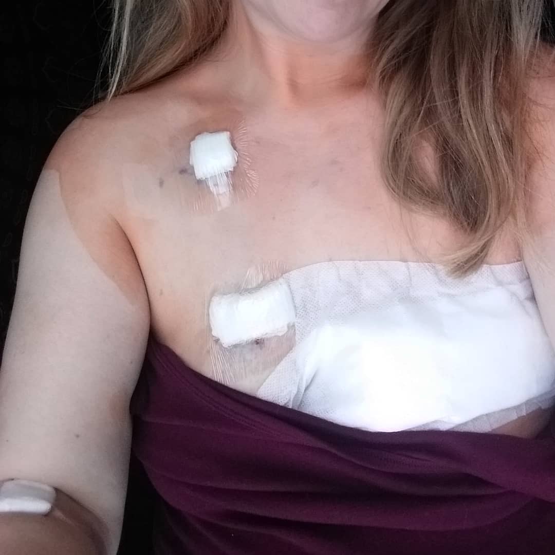 "Questo è il cancro al seno: ve lo mostro senza nascondervi nulla”