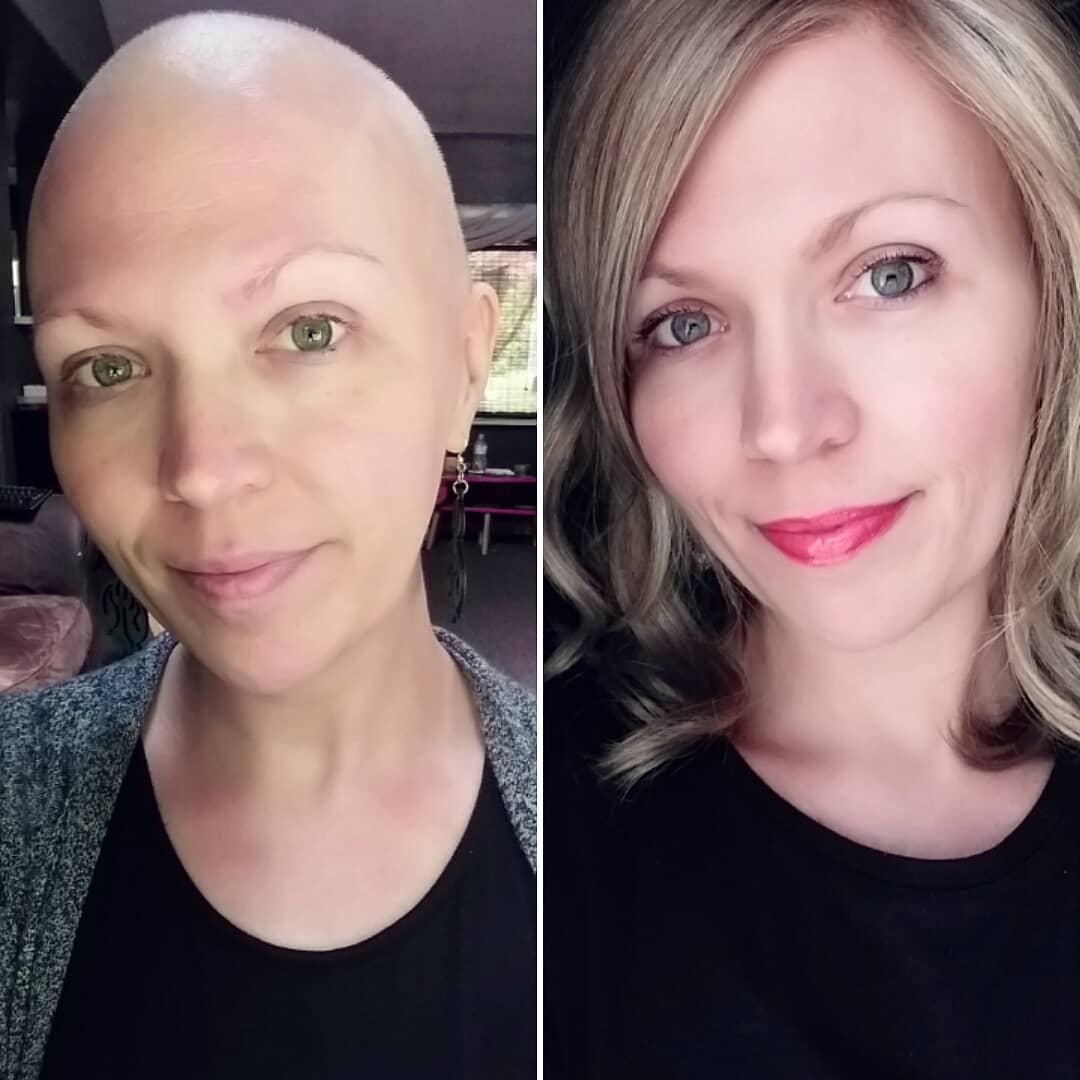 "Questo è il cancro al seno: ve lo mostro senza nascondervi nulla”