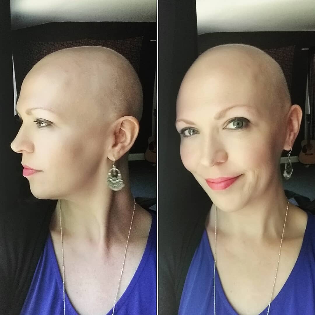 "Questo è il cancro al seno: ve lo mostro senza nascondervi nulla”