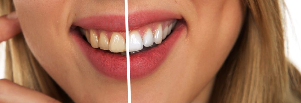 Cosa succede al nostro corpo quando svapiamo VS quando fumiamo