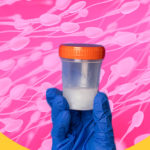Spermiogramma: cosa ci possono dire le analisi del liquido seminale