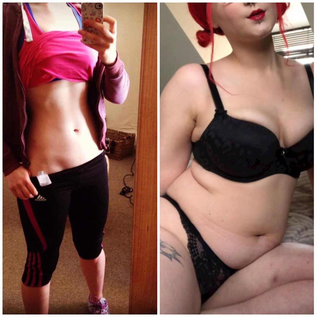 "La menopausa indotta sta cambiando il mio corpo e io non sono pronta"