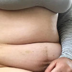 "La menopausa indotta sta cambiando il mio corpo e io non sono pronta"