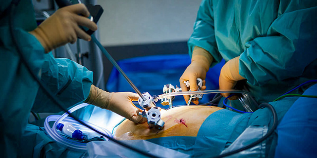 asportazione utero