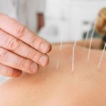Ritrovare il benessere con l'agopuntura: cosa ne pensa la medicina ufficiale?