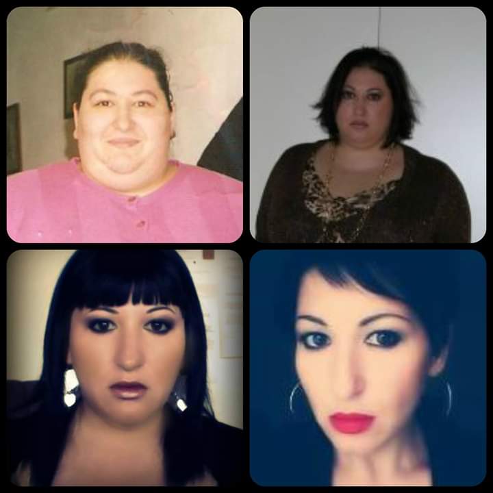 "Sono arrivata a pesare 220 kg e no: gli obesi non sono tutti pigri e mangioni"