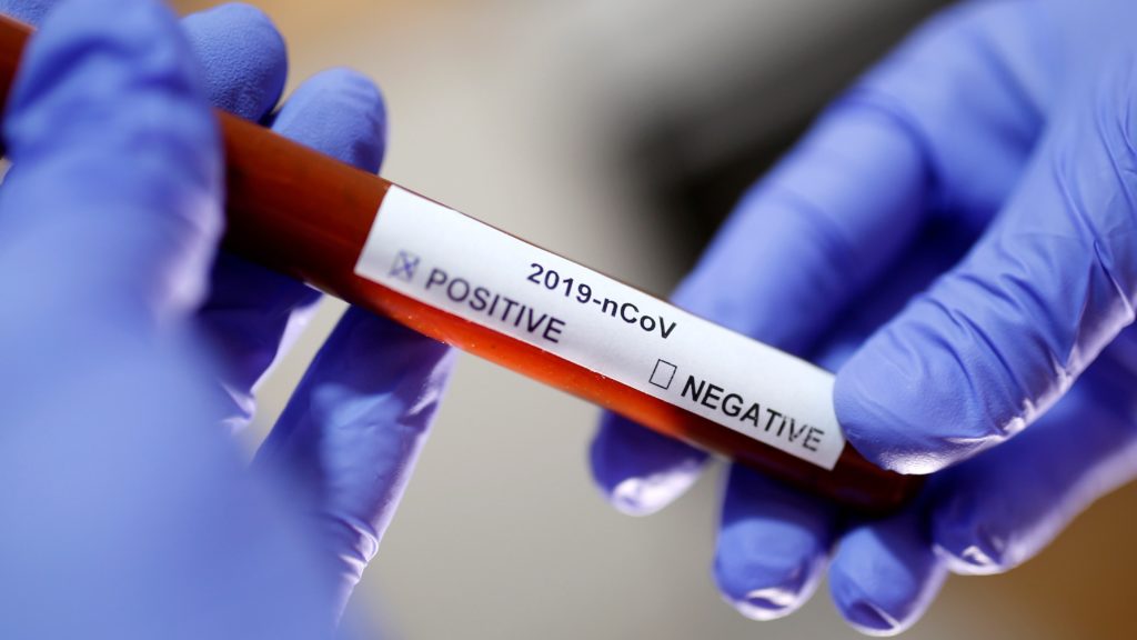 Coronavirus: il rischio di essere asintomatico positivo