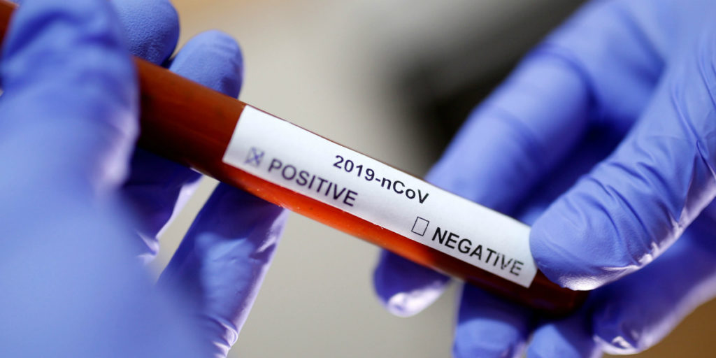Coronavirus: il rischio di essere asintomatico positivo