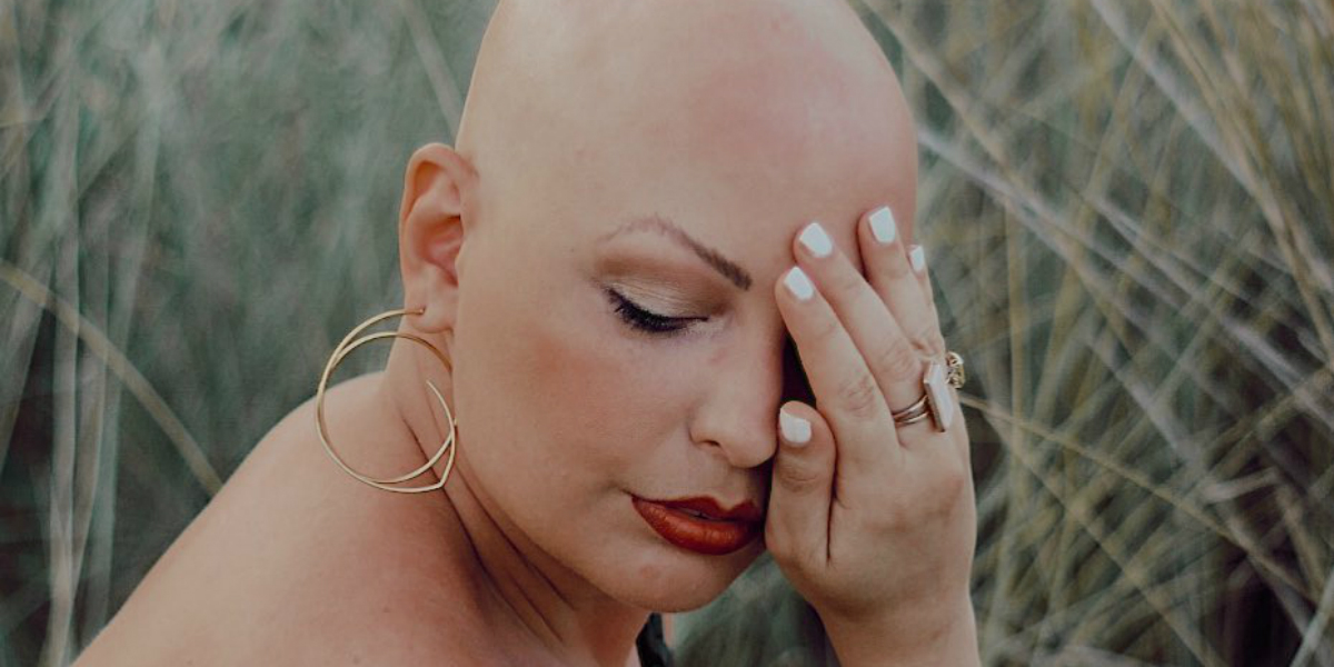 Carolina marconi positiva contro il tumore: le parole dell'ex gieffina Sono calva e mi amo: dall'alopecia ho imparato che una donna non è i