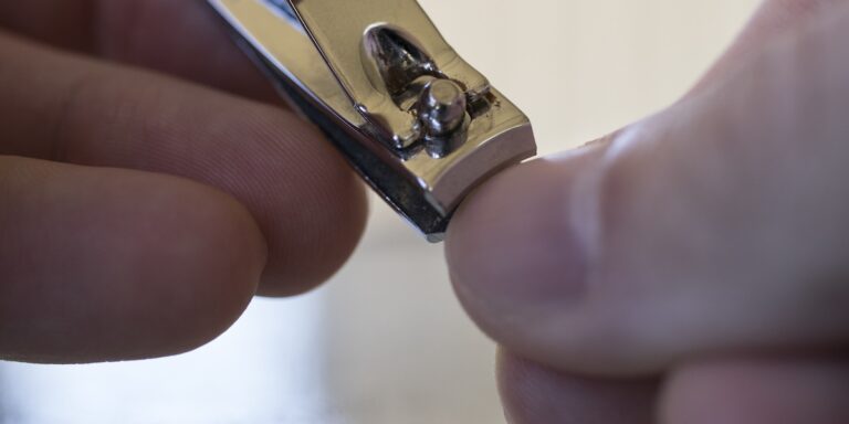 Coilonichia Cause E Trattamento Roba Da Donne