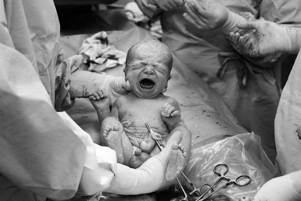 Il Miracolo della Vita: 46 Scatti dell'Istante Dopo la Nascita