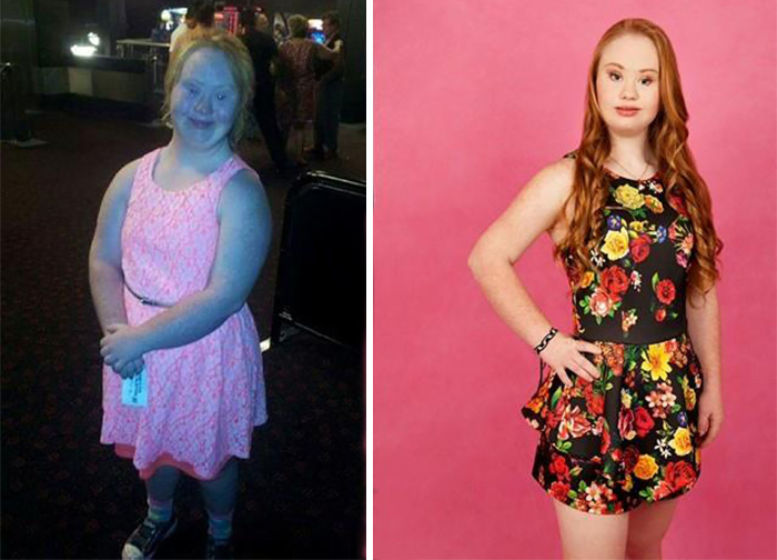 Madeline Stuart, Affetta dalla Sindrome di Down Sogna di Fare la Modella