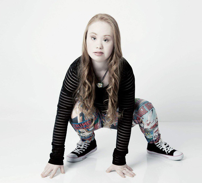 Madeline Stuart, Affetta dalla Sindrome di Down Sogna di Fare la Modella