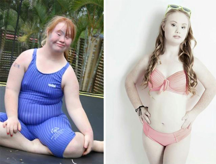 Madeline Stuart, Affetta dalla Sindrome di Down Sogna di Fare la Modella