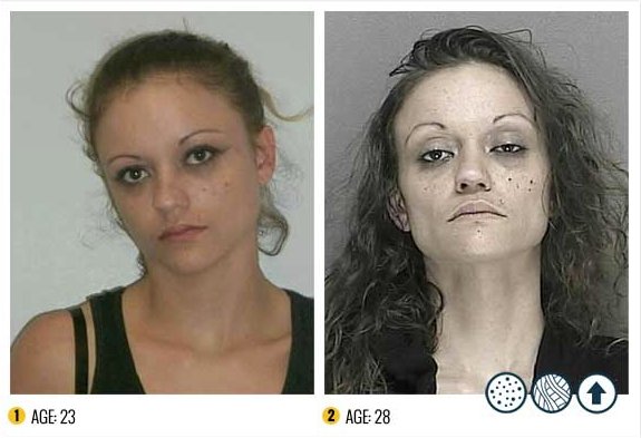 I Terribili Effetti della Droga sul Nostro Corpo: le Foto Shock