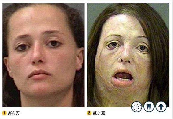 I Terribili Effetti della Droga sul Nostro Corpo: le Foto Shock