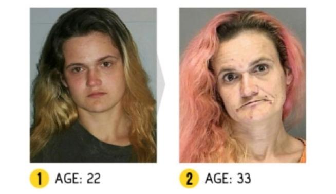 I Terribili Effetti della Droga sul Nostro Corpo: le Foto Shock