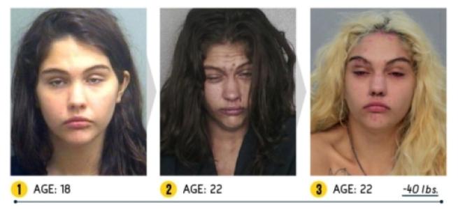 I Terribili Effetti della Droga sul Nostro Corpo: le Foto Shock