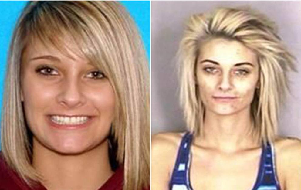 I Terribili Effetti della Droga sul Nostro Corpo: le Foto Shock