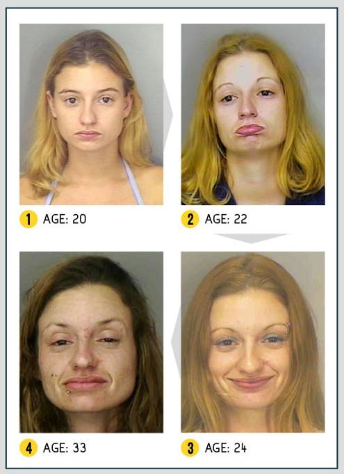 I Terribili Effetti della Droga sul Nostro Corpo: le Foto Shock