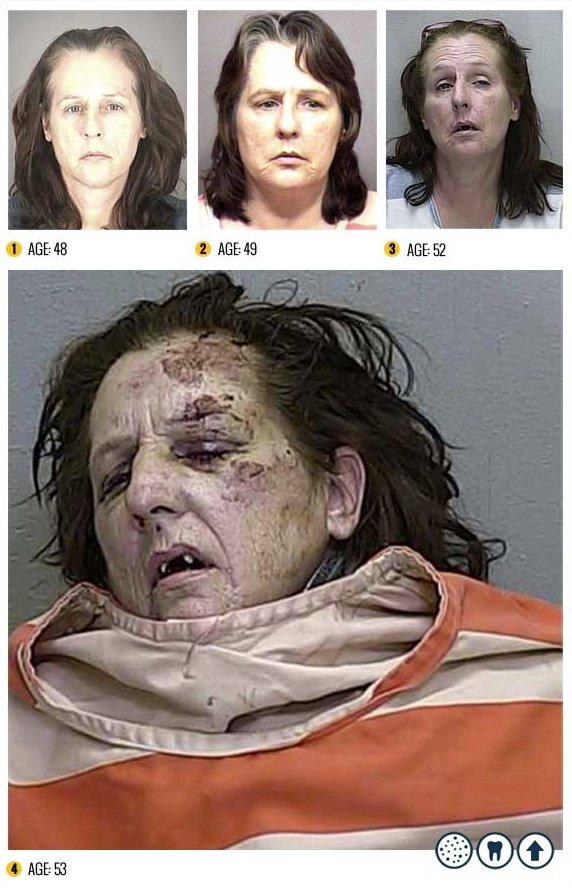 I Terribili Effetti della Droga sul Nostro Corpo: le Foto Shock