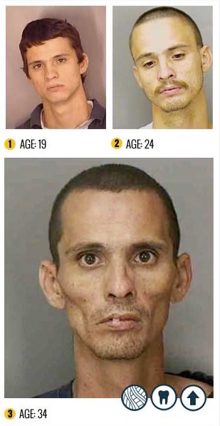 I Terribili Effetti della Droga sul Nostro Corpo: le Foto Shock