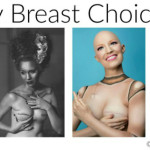 My Breast Choice: il racconto "ironico" in immagini della mastectomia di Aniela
