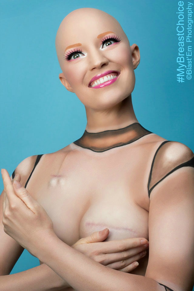 My Breast Choice: il racconto "ironico" in immagini della mastectomia di Aniela