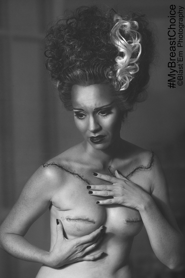 My Breast Choice: il racconto "ironico" in immagini della mastectomia di Aniela