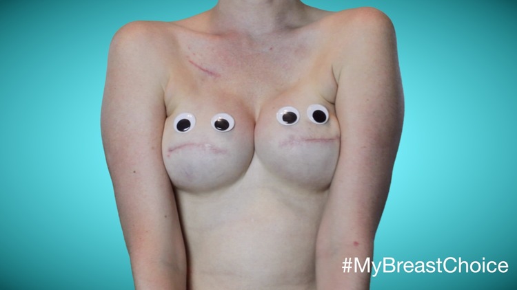 My Breast Choice: il racconto "ironico" in immagini della mastectomia di Aniela