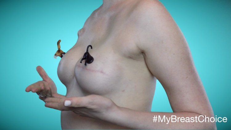 My Breast Choice: il racconto "ironico" in immagini della mastectomia di Aniela