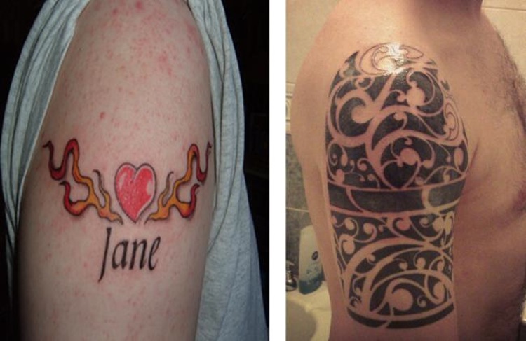 40 Tatuaggi Venuti Male e (Fortunatamente) Ricostruiti!
