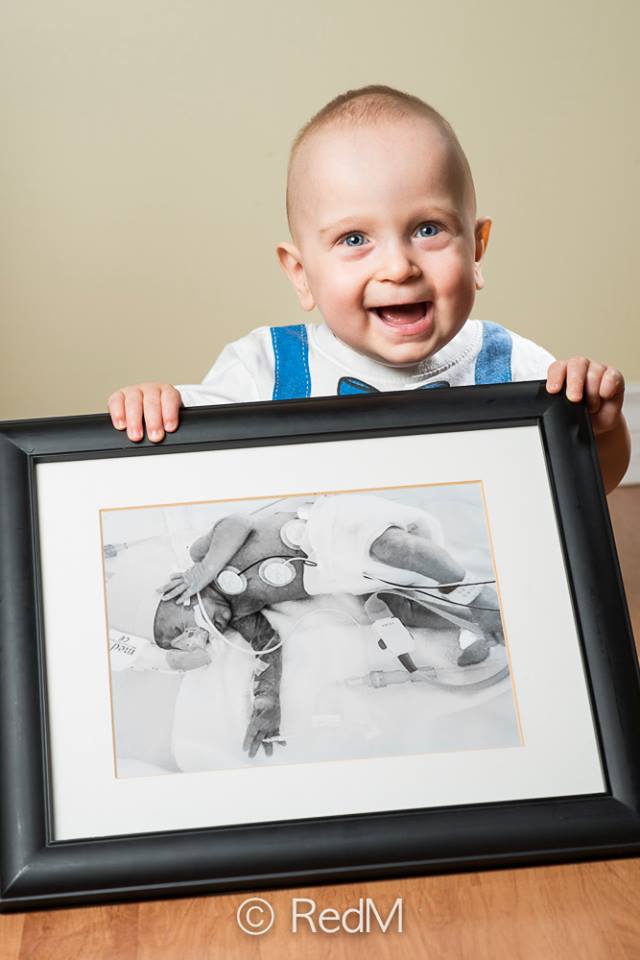 37 Bambini Nati Prematuri che ce l'Hanno Fatta e Mostrano i loro Sorrisi!