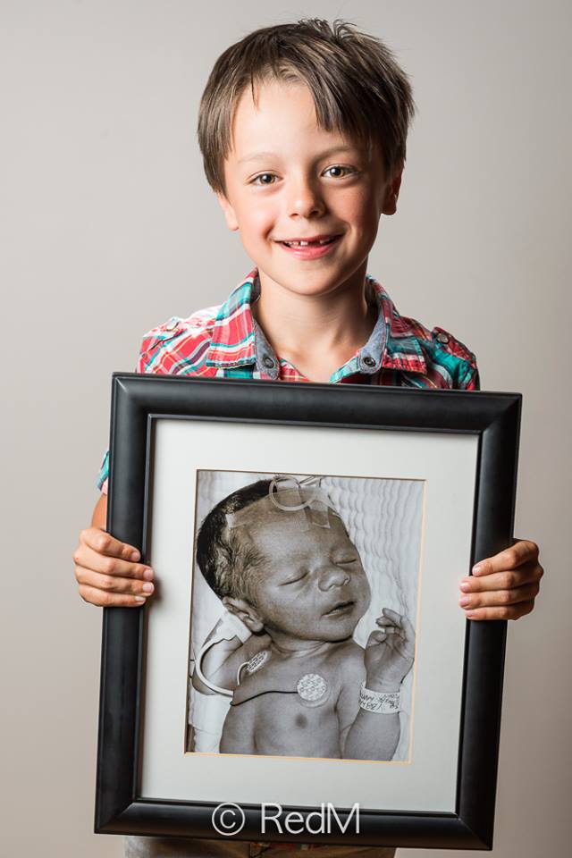 37 Bambini Nati Prematuri che ce l'Hanno Fatta e Mostrano i loro Sorrisi!