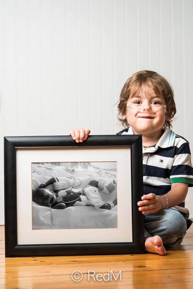 37 Bambini Nati Prematuri che ce l'Hanno Fatta e Mostrano i loro Sorrisi!